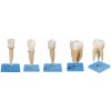 TEETH MODEL (SET OF 5)